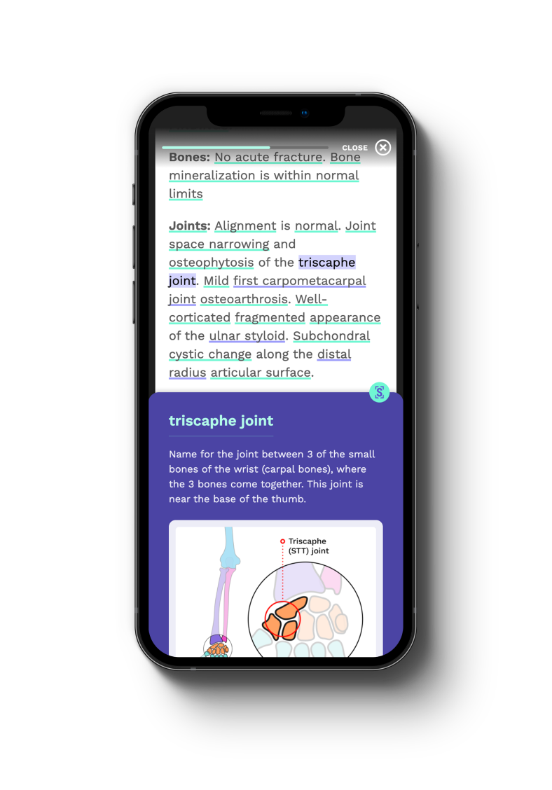 Scanslated Patient Friendly Reports at Touchstone Medical Imaging